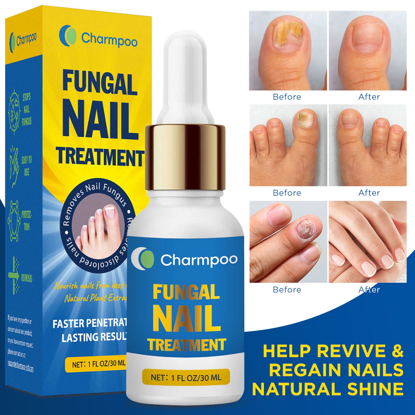 Charmpoo Fungus Nail Treatment (for Toenail)