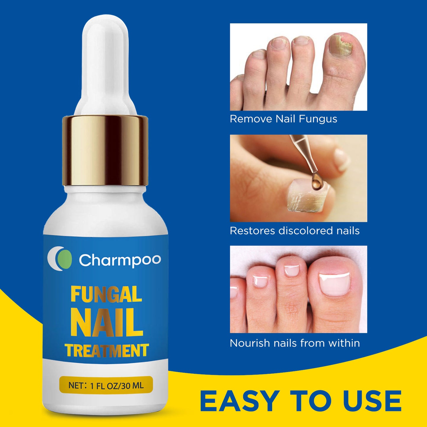 Charmpoo Fungus Nail Treatment (for Toenail)